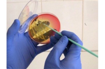 Ureaplazma jako možná příčina neplodnosti