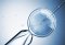 IUI – inseminácia