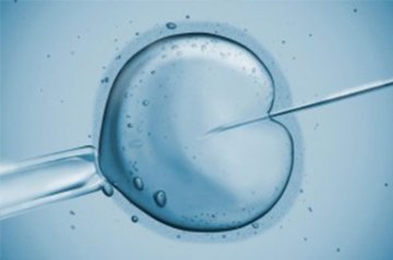 Kolik stojí léčba neplodnosti a umělé oplodnění IVF?